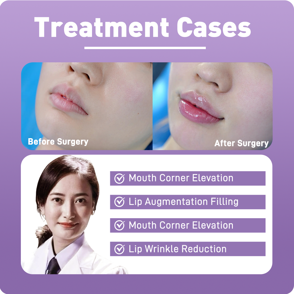 Artistic Facial Sculpting · Smile Lip Sculpting