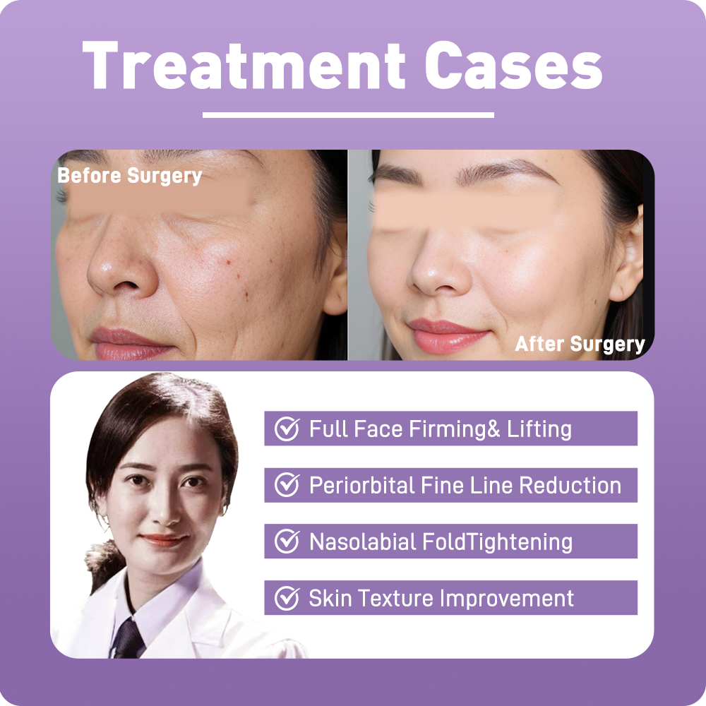 Artistic Facial Sculpting · RF Skin Tightening