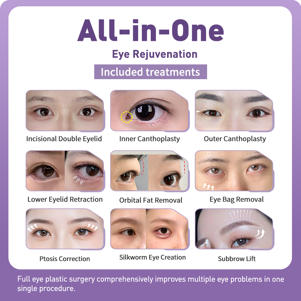 Artful Face Sculpting With Precision Eye Definition