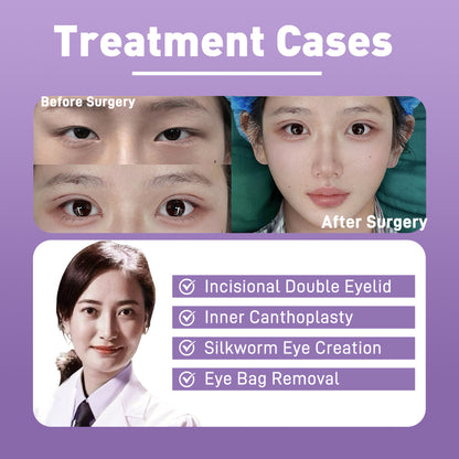 Artful Face Sculpting With Precision Eye Definition