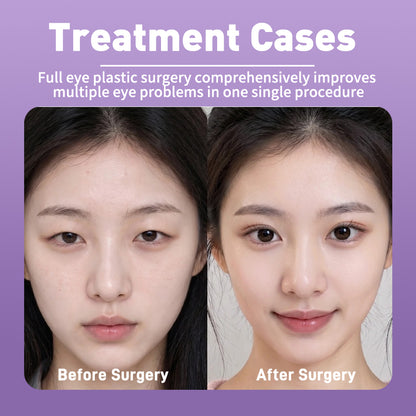 Artful Face Sculpting With Precision Eye Definition