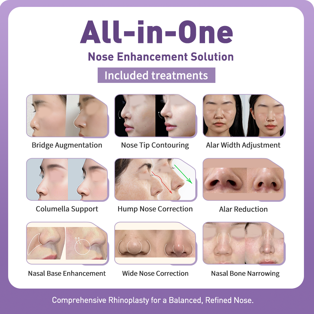 3D Nose Sculpting & Refinement
