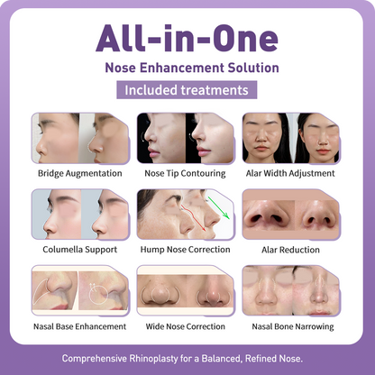 3D Nose Sculpting & Refinement