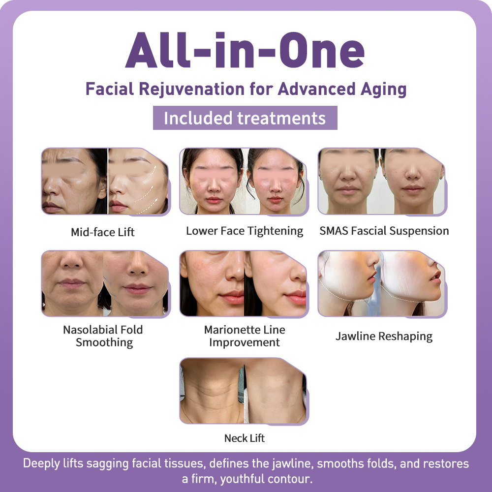 Artistic Facial Sculpting · Deep Plane Facelift