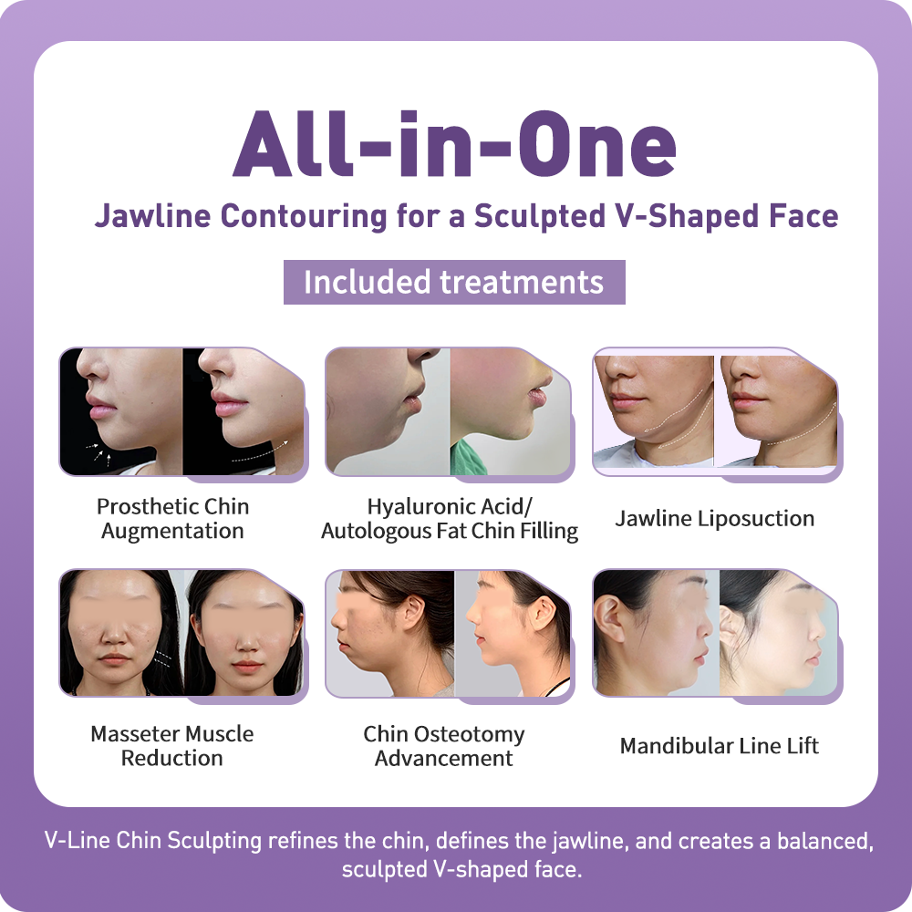 Artistic Facial Sculpting · V-Line Chin Sculpting