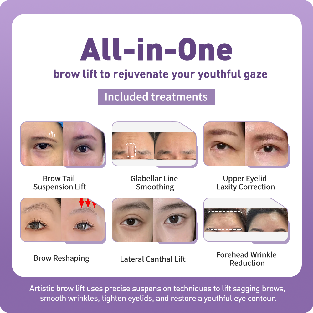 Artistic Facical Sculpting · Brow Lift
