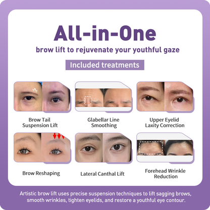 Artistic Facical Sculpting · Brow Lift