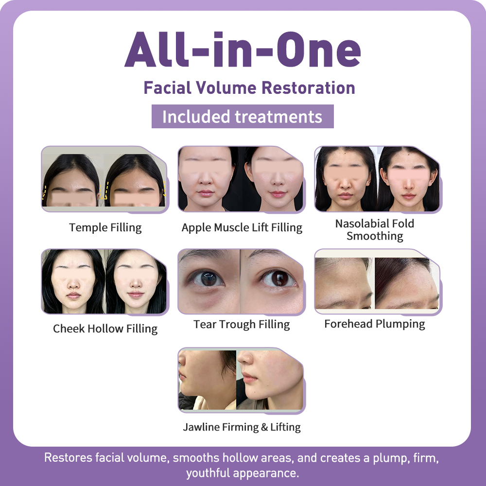 Artistic Facial Sculpting · Youthful Volume Restoration