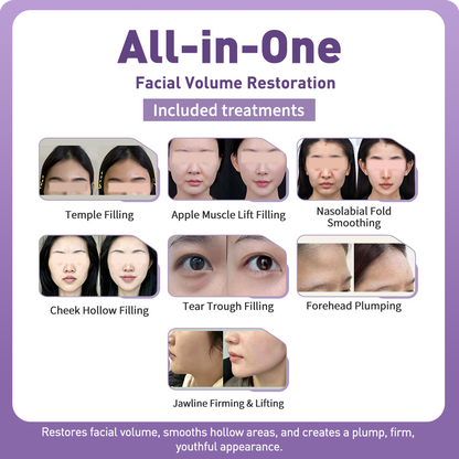 Artistic Facial Sculpting · Youthful Volume Restoration