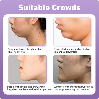 Artistic Facial Sculpting · V-Line Chin Sculpting