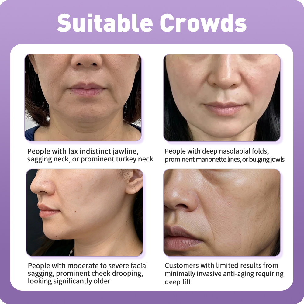 Artistic Facial Sculpting · Deep Plane Facelift