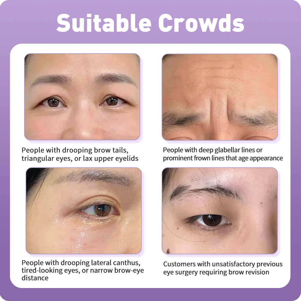 Artistic Facical Sculpting · Brow Lift