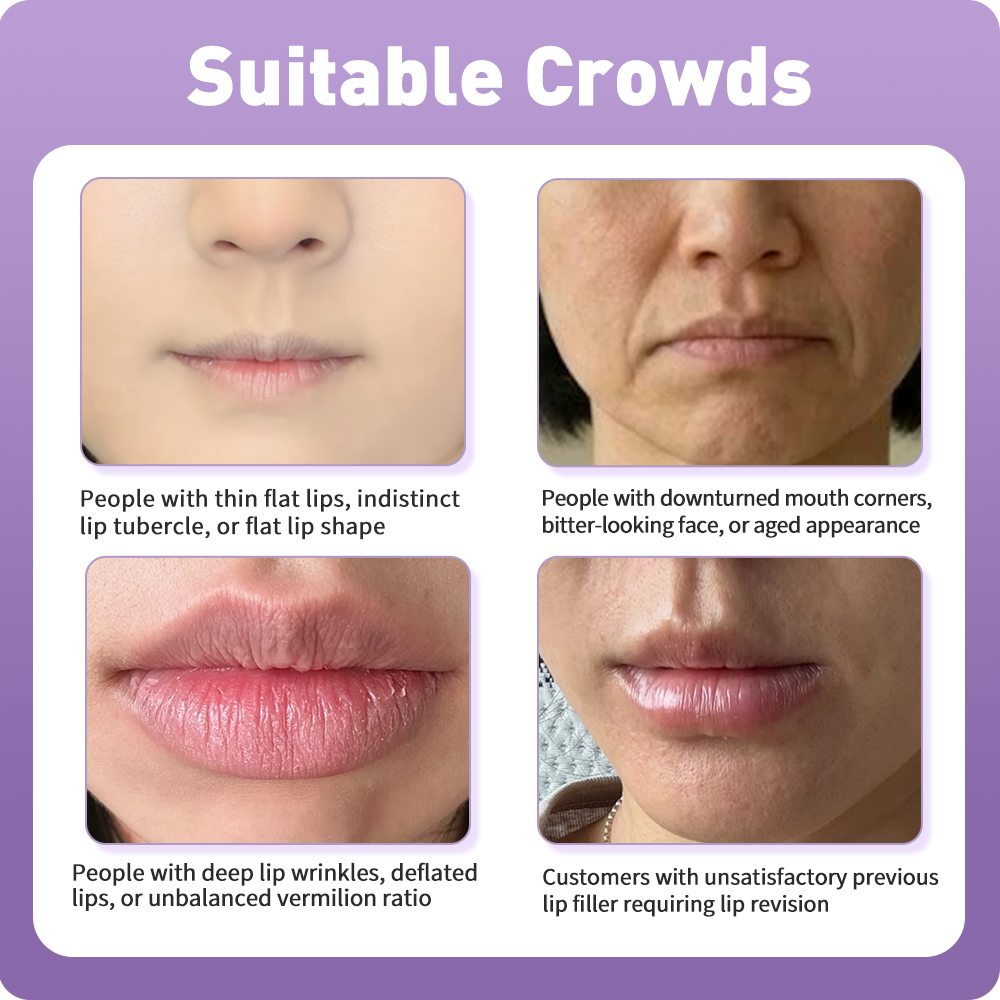 Artistic Facial Sculpting · Smile Lip Sculpting