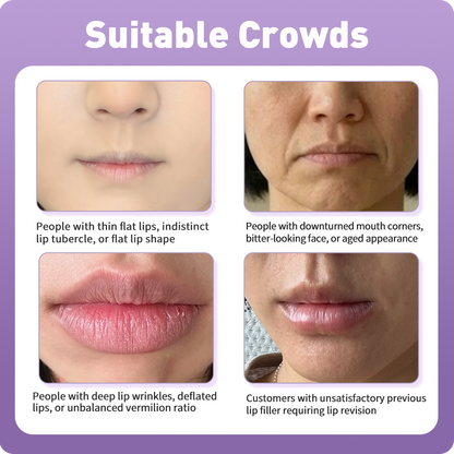 Artistic Facial Sculpting · Smile Lip Sculpting