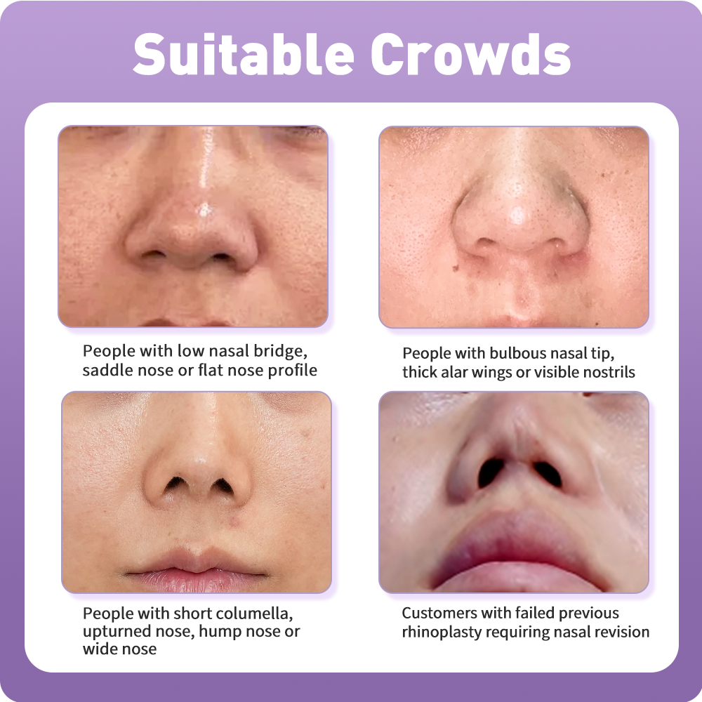 3D Nose Sculpting & Refinement