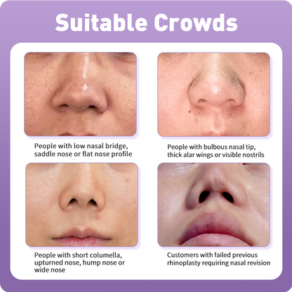 3D Nose Sculpting & Refinement