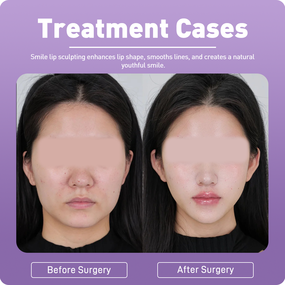 Artistic Facial Sculpting · Smile Lip Sculpting