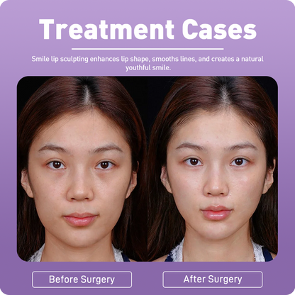 Artistic Facial Sculpting · Smile Lip Sculpting
