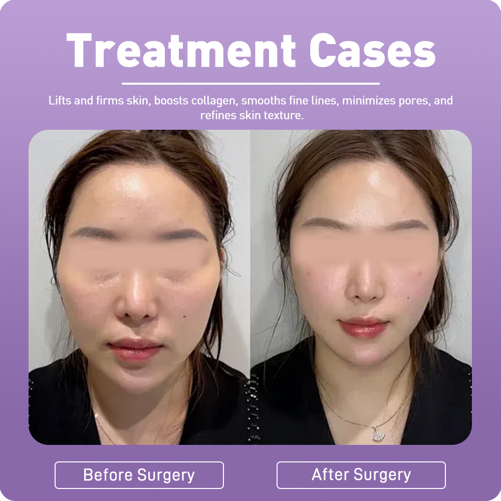 Artistic Facial Sculpting · RF Skin Tightening