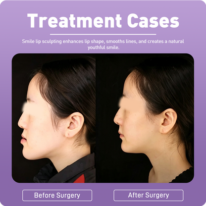 Artistic Facial Sculpting · V-Line Chin Sculpting