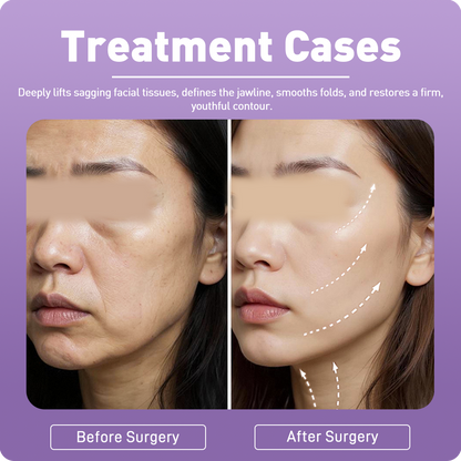 Artistic Facial Sculpting · Deep Plane Facelift