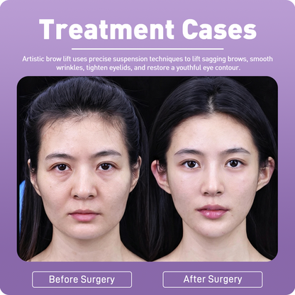 Artistic Facical Sculpting · Brow Lift
