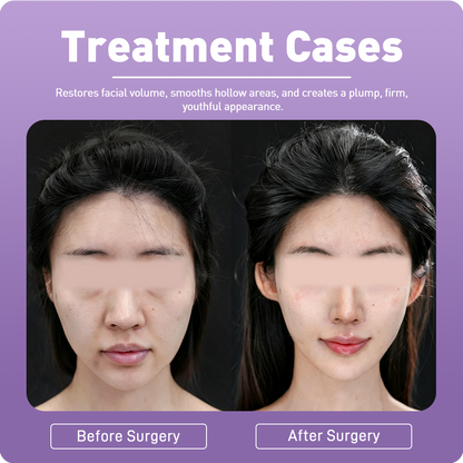 Artistic Facial Sculpting · Youthful Volume Restoration