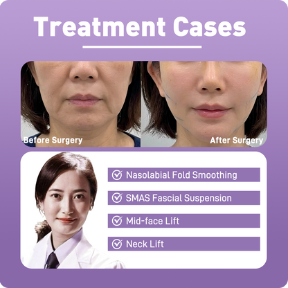 Artistic Facial Sculpting · Deep Plane Facelift