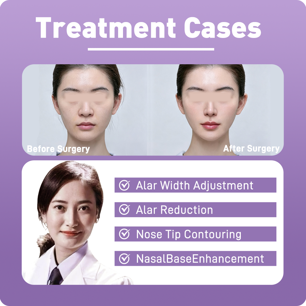 3D Nose Sculpting & Refinement