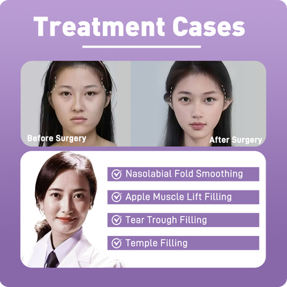Artistic Facial Sculpting · Youthful Volume Restoration