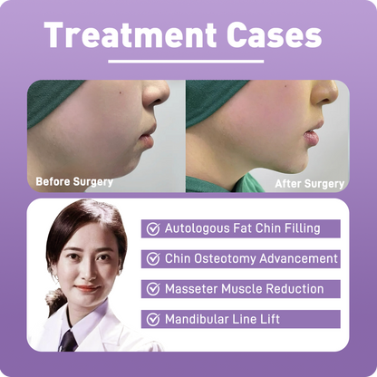 Artistic Facial Sculpting · V-Line Chin Sculpting