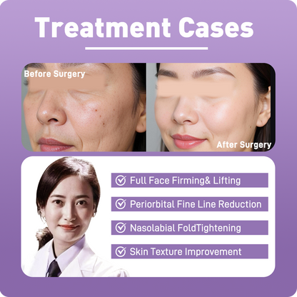 Artistic Facial Sculpting · RF Skin Tightening